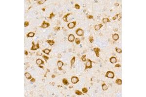 Immunohistochemistry of paraffin-embedded mouse brain using HDLBP Rabbit mAb (ABIN7267644) at dilution of 1:50 (40x lens). (HDLBP anticorps)