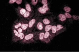 Immunofluorescent staining of Hela cells. (EZH2 anticorps  (AA 156-256))