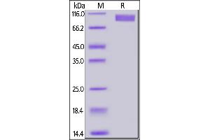 Biotinylated Human GUCY2C, Fc,Avitag on  under reducing (R) condition. (GUCY2C Protein (AA 24-430) (Fc Tag,AVI tag,Biotin))