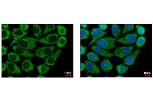 ICC/IF Image COX6B1 antibody [N2C3] detects COX6B1 protein at mitochondria by immunofluorescent analysis. (COX6B1 anticorps  (C-Term))