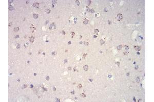 Immunohistochemical analysis of paraffin-embedded brain tissues using mTOR mouse mAb with DAB staining.