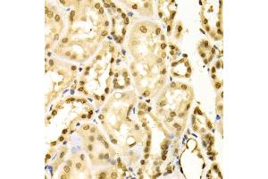 Immunohistochemistry of paraffin-embedded human kidney using MAPK3 Antibody (ABIN5970057) at dilution of 1/100 (40x lens). (ERK1 anticorps  (N-Term))