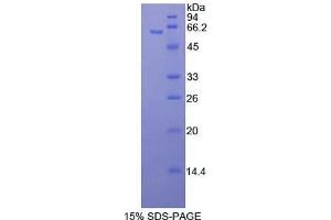 SDS-PAGE analysis of Human MAP2K4 Protein. (MAP2K4 Protéine)