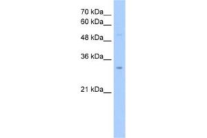 anti-NOP2/Sun Domain Family, Member 5 Pseudogene 2 (NSUN5P2) (Middle Region) antibody