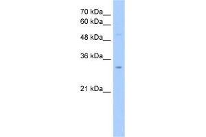 WB Suggested Anti-NSUN5C Antibody Titration:  2. (NSUN5P2 anticorps  (Middle Region))