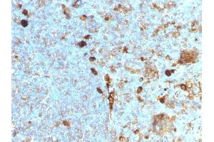 Formalin-fixed, paraffin-embedded human Tonsil stained with Alpha-1-Antitrypsin Mouse Monoclonal Antibody (AAT/1378). (SERPINA1 anticorps)