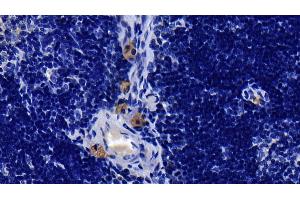 Detection of IL1R1 in Rat Thymus Tissue using Polyclonal Antibody to Interleukin 1 Receptor Type I (IL1R1)