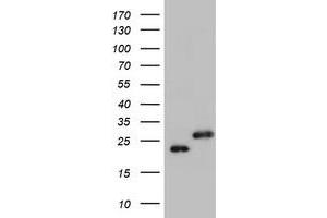 Image no. 1 for anti-Ubiquitin-Conjugating Enzyme E2E 3 (UBE2E3) antibody (ABIN1501628) (UBE2E3 anticorps)