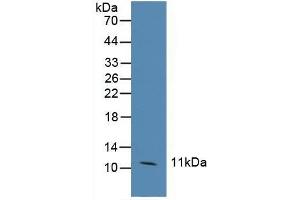 Detection of CCL6 in Human Hela Cells using Polyclonal Antibody to Chemokine (C-C motif) ligand 6 (CCL6) (CCL6 anticorps  (AA 21-115))