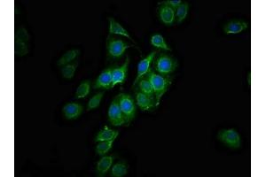 Immunofluorescence staining of HepG2 cells with ABIN7147479 at 1:100, counter-stained with DAPI. (GLTPD1 anticorps  (AA 1-214))