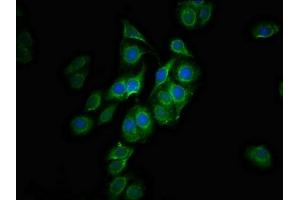 Immunofluorescence staining of HepG2 cells with ABIN7147479 at 1:100, counter-stained with DAPI. (GLTPD1 anticorps  (AA 1-214))