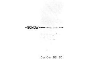 Western blot analysis of MARCKS in whole rat cortex (Co), cerebellum (Ce), brain stem (BS) and spinal cord (SC) homogenate stained with MARCKS polyclonal antibody  at dilution of 1 : 10,000. (MARCKS anticorps)