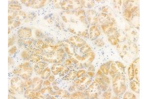 ABIN6264828 and ABIN6278632 at 1/100 staining human normal kidney tissue by IHC-P. (RPL14 anticorps  (Internal Region))