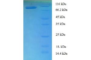 SDS-PAGE (SDS) image for T-Box 18 (TBX18) (AA 1-607), (full length) protein (His-SUMO Tag) (ABIN5710464)