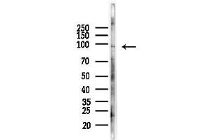 Western blot analysis of lysates from COLO205 cells(heat-shock,45 min treatment), using KCNQ5 Antibody at 1/1000 dilution.