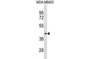 Western Blotting (WB) image for anti-Mitochondrial Ribosomal Protein L46 (MRPL46) antibody (ABIN3000730) (MRPL46 anticorps)