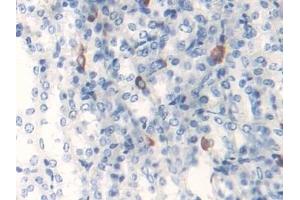 Detection of MAOB in Mouse Kidney Tissue using Polyclonal Antibody to Monoamine Oxidase B (MAOB)