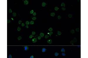 Immunofluorescence analysis of THP-1 cells using CHAT Polyclonal Antibody at dilution of 1:100. (Choline Acetyltransferase anticorps)