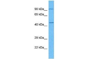 Host:  Rabbit  Target Name:  E2F3  Sample Tissue:  Human Lung Tumor  Antibody Dilution:  1ug/ml (E2F3 anticorps  (C-Term))