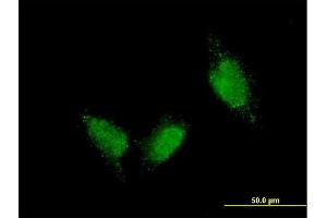 Immunofluorescence of monoclonal antibody to TTN on HeLa cell.