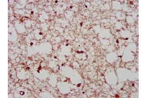 IHC image of ABIN7163794 diluted at 1:400 and staining in paraffin-embedded human brain tissue performed on a Leica BondTM system.