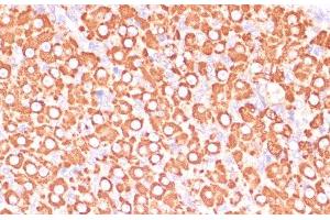 Immunohistochemistry of paraffin-embedded Rat ovary using MAP2K3 Polyclonal Antibody at dilution of 1:100 (40x lens). (MAP2K3 anticorps)