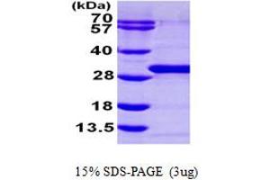 SDS-PAGE (SDS) image for RAB21, Member RAS Oncogene Family (RAB21) (AA 18-222) protein (His tag) (ABIN7529166)