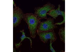 Immunofluorescence analysis of A549 cells using RAB25 mouse mAb (green). (RAB25 anticorps)