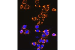 Immunofluorescence analysis of NIH-3T3 cells using IFN Rabbit pAb (ABIN7267947) at dilution of 1:100 (40x lens). (IFNAR1 anticorps  (AA 470-557))
