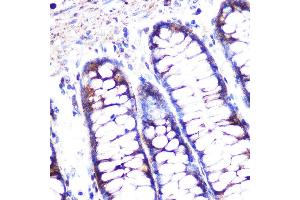 Confocal immunofluorescence analysis of Raw264.
