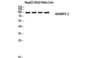 Western Blot (WB) analysis of HepG2 K562 HeLa Colo using ADAMTS-2 antibody. (Adamts2 anticorps)