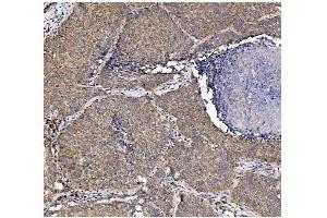 IHC analysis of PFKFB2 using anti-PFKFB2 antibody (ABIN7601627). (PFKFB2 anticorps  (AA 4-505))
