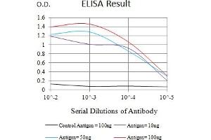 Black line: Control Antigen (100 ng),Purple line: Antigen (10 ng), Blue line: Antigen (50 ng), Red line:Antigen (100 ng)