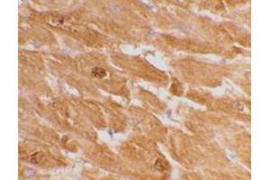 Immunohistochemical staining of human heart tissue using AP30192PU-N caspase-12 antibody (large) at 2 μg/ml.