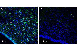 Expression of NPFFR1 in rat hypothalamusImmunohistochemical staining of perfusion-fixed frozen rat brain sections with Anti-Neuropeptide FF Receptor 1 (extracellular) Antibody (ABIN7581921), (1:400), followed by goat anti-rabbit-AlexaFluor-488. (NPFFR1 anticorps  (Extracellular))