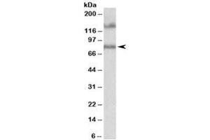 Western blot testing of human hippocampus lysate with EPB41L5 antibody at 1ug/ml. (EPB41L5 anticorps)