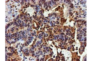 Image no. 6 for anti-Proteasome (Prosome, Macropain) Subunit, beta Type, 9 (Large Multifunctional Peptidase 2) (PSMB9) (AA 21-219) antibody (ABIN1491194)