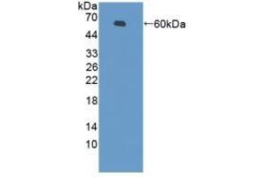 Detection of Recombinant PZP, Mouse using Polyclonal Antibody to Pregnancy Zone Protein (PZP)