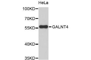 Western blot analysis of extracts of HeLa cells, using GALNT4 antibody (ABIN5972364). (GALNT4 anticorps)