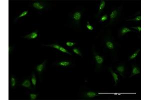 Immunofluorescence of monoclonal antibody to D4S234E on HeLa cell. (NSG1 anticorps  (AA 1-185))