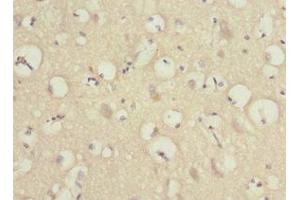 Immunohistochemistry of paraffin-embedded human brain tissue using ABIN7165996 at dilution of 1:100 (PRUNE2 anticorps  (AA 1-250))