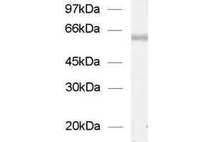 dilution: 1 : 1000, sample: enriched vesicles from rat spinal chord (ChT anticorps  (AA 501-580))