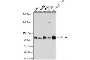 Western blot analysis of extracts of various cell lines using UGT1A6 Polyclonal Antibody at dilution of 1:1000. (UGT1A6 anticorps)