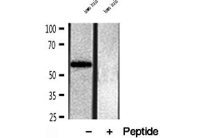 Western blot analysis of extracts of human brain tissue, using OXCT1 antibody. (OXCT1 anticorps  (Internal Region))