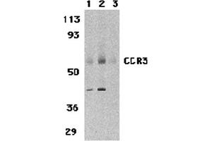 Western Blotting (WB) image for anti-Chemokine (C-C Motif) Receptor 3 (CCR3) (N-Term) antibody (ABIN1031307) (CCR3 anticorps  (N-Term))