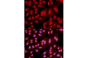 Immunofluorescence analysis of U2OS cells using PPP2R2A antibody (ABIN6291584).