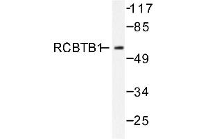 Image no. 1 for anti-Regulator of Chromosome Condensation (RCC1) and BTB (POZ) Domain Containing Protein 1 (RCBTB1) antibody (ABIN271804) (RCBTB1 anticorps)