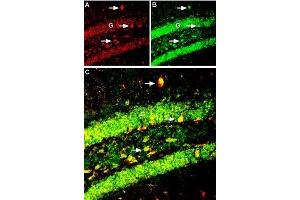 Multiplex staining of Kir6. (Brain-Derived Neurotrophic Factor (BDNF) Peptide)