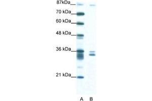 Western Blotting (WB) image for anti-PBX/knotted 1 Homeobox 2 (PKNOX2) antibody (ABIN2460704) (PKNOX2 anticorps)