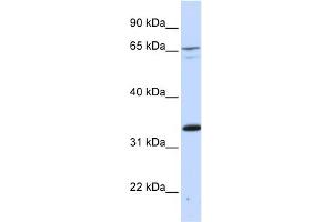 WB Suggested Anti-PSIP1 Antibody Titration:  0. (PSIP1 anticorps  (Middle Region))